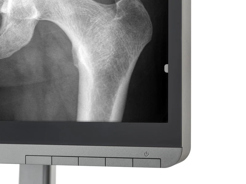 Pair (x2) JVC Totoku CL-S500 5MP 21" Color Mammo 3D-DBT Breast Imaging Display (CL-S500)