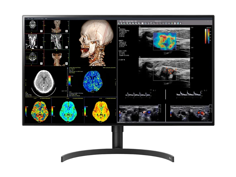 LG 8MP Fusion 4K 32" 32HL512D-B Color Medical Diagnostic Radiology Monitor 450 cd/m² DICOM Brightness