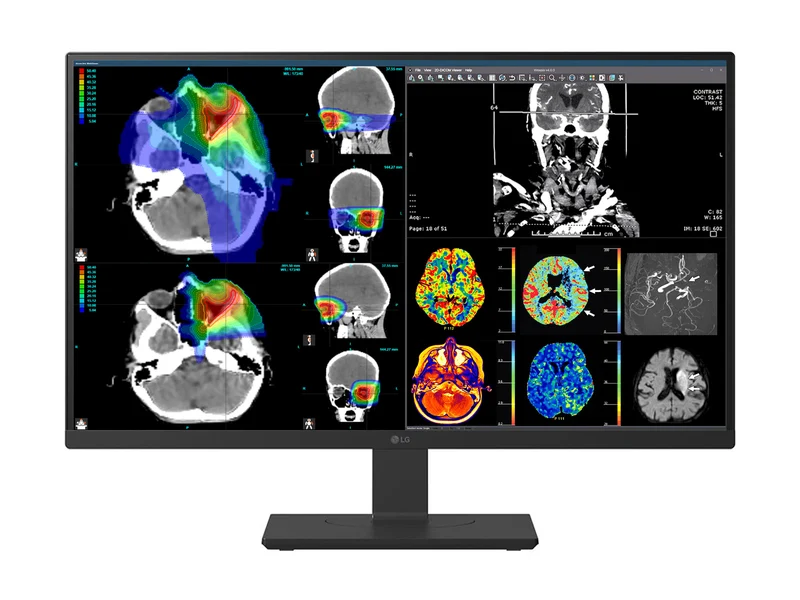 LG 27" 27HS713C Fusion 8MP 4K Clinical Review Medical DICOM Display Monitor