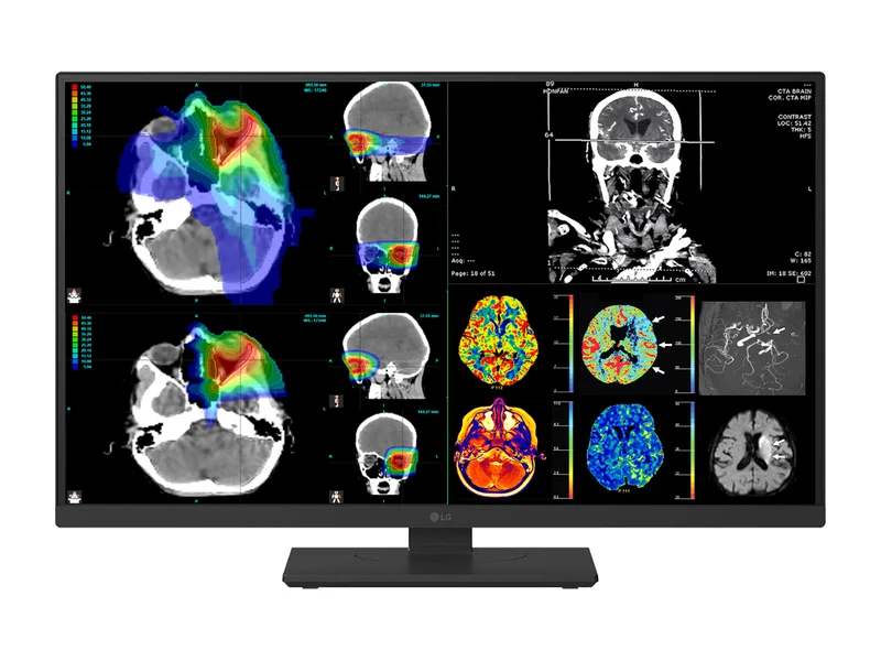 LG 27" 27HS713C Fusion 8MP 4K Clinical Review Medical DICOM Display Monitor