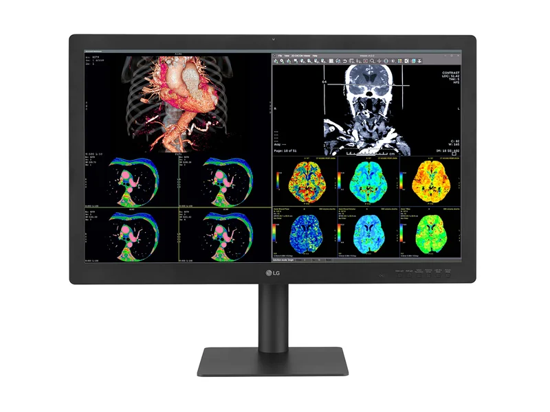 LG 32HQ713D-B 8MP 32" Diagnostic Fusion Color Medical Radiology PACS Monitor - 1000 cd/m² DICOM Brightness