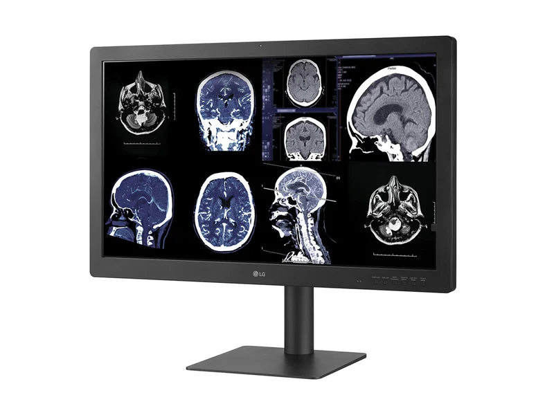 LG 32HQ713D-B 8MP 32" Diagnostic Fusion Color Medical Radiology PACS Monitor - 1000 cd/m² DICOM Brightness