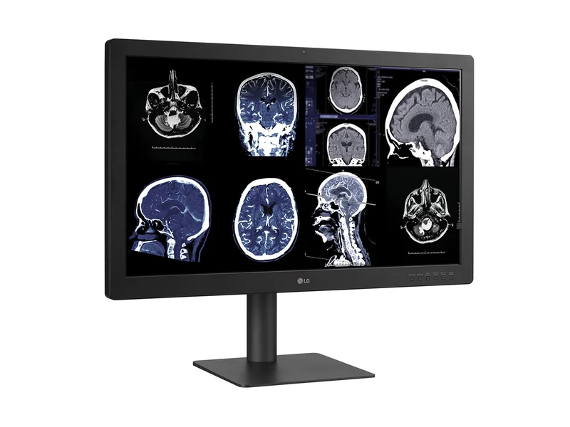 LG 32HQ713D-B 8MP 32" Diagnostic Fusion Color Medical Radiology PACS Monitor - 1000 cd/m² DICOM Brightness