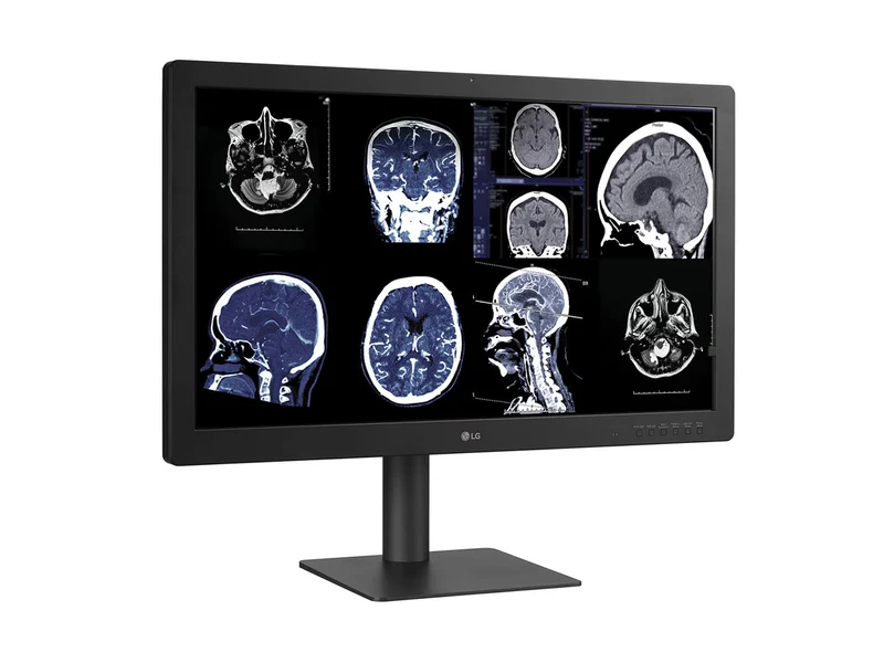 LG 32HQ713D-B 8MP 32" Diagnostic Fusion Color Medical Radiology PACS Monitor - 1000 cd/m² DICOM Brightness