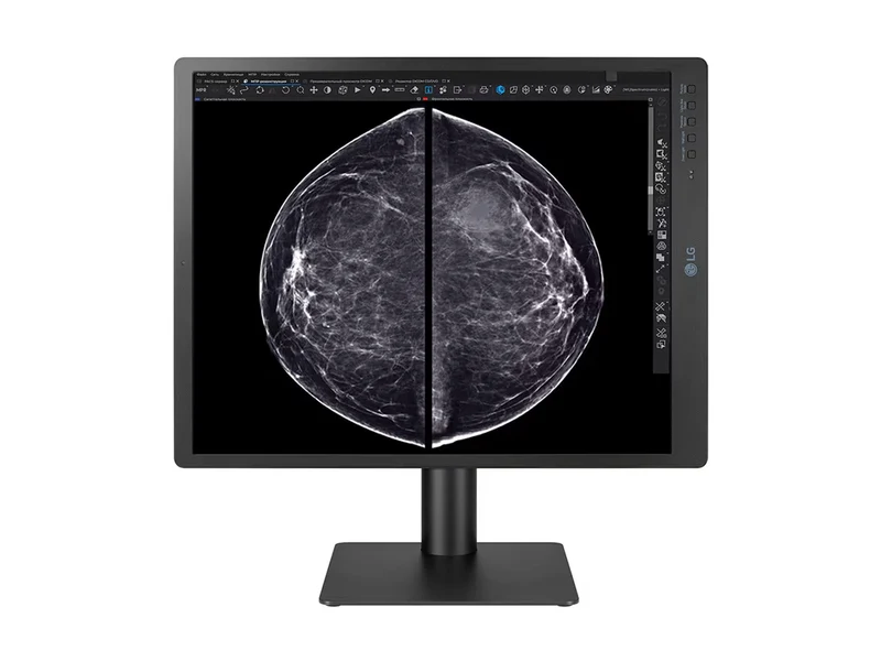 LG 5MP 21" 21HQ613D-B Color Mammography 3D-Tomosynthesis Breast Imaging Display Monitor