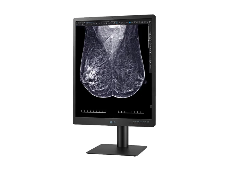 LG 5MP 21" 21HQ613D-B Color Mammography 3D-Tomosynthesis Breast Imaging Display Monitor