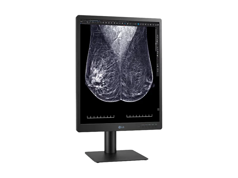 LG 5MP 21" 21HQ613D-B Color Mammography 3D-Tomosynthesis Breast Imaging Display Monitor