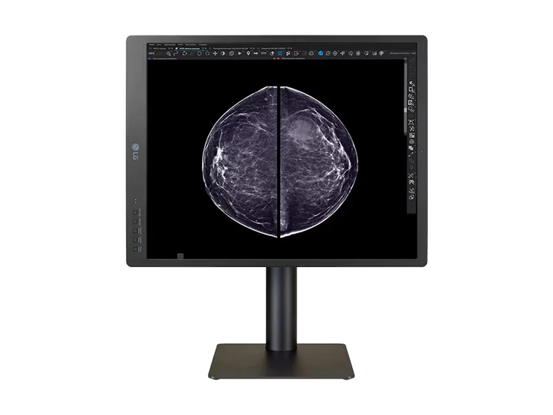 LG 5MP 21" 21HQ613D-B Color Mammography 3D-Tomosynthesis Breast Imaging Display Monitor