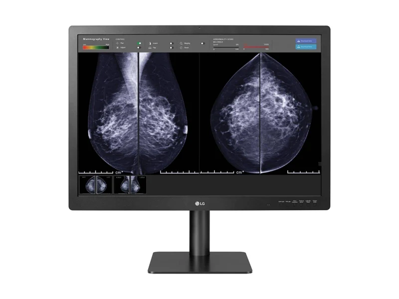 LG 12MP Fusion 31.5" 31HN713D-B Color Mammography 3D-Tomosynthesis Breast Imaging Display