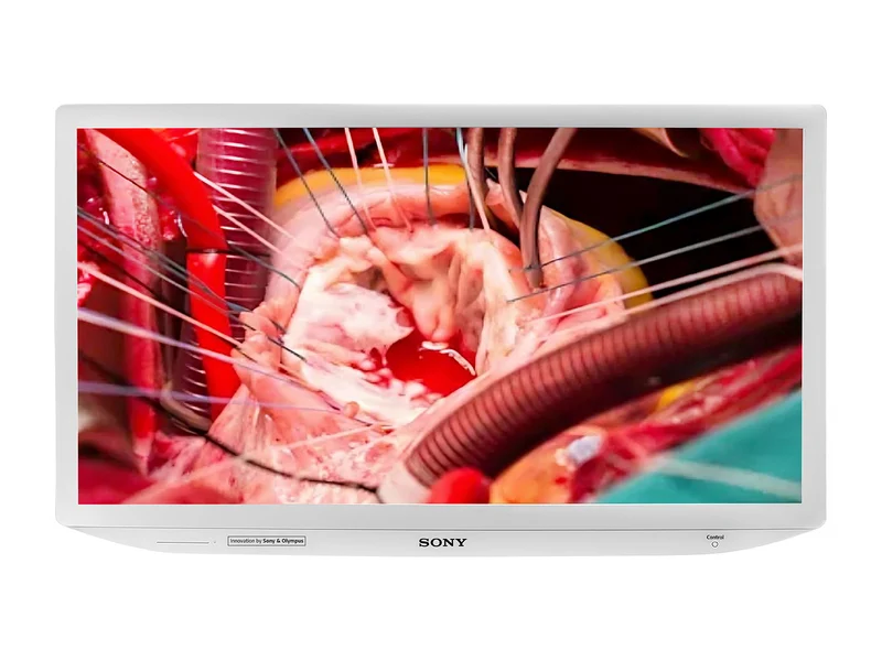 Sony LMD-X310S 31" LCD 4K Surgical Medical Display Monitor (LMD-X310S)
