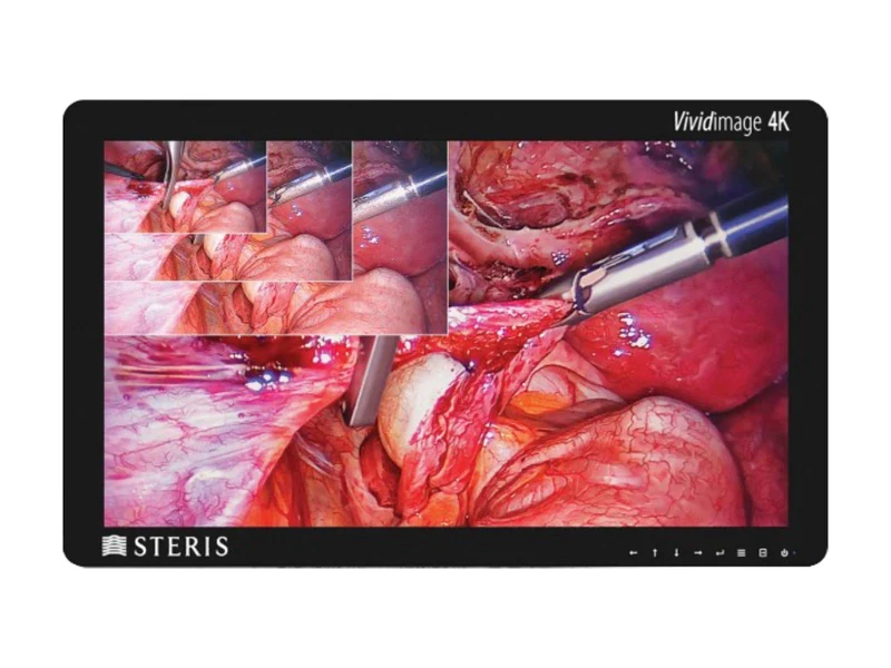 Steris Vividimage RLM314KC 31" 8MP 4K LED Surgical Display Monitor (STERIS-31-4K-R)