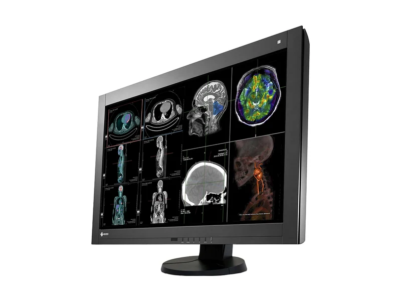Eizo RadiForce RX440 4MP 30" Color General Radiology PACS Display (RX440-BK)