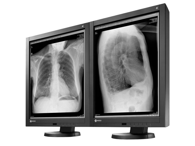 Eizo RadiForce GX340 3MP 21" Grayscale General Radiology Diagnostic Display Monitor (GX340-CL)