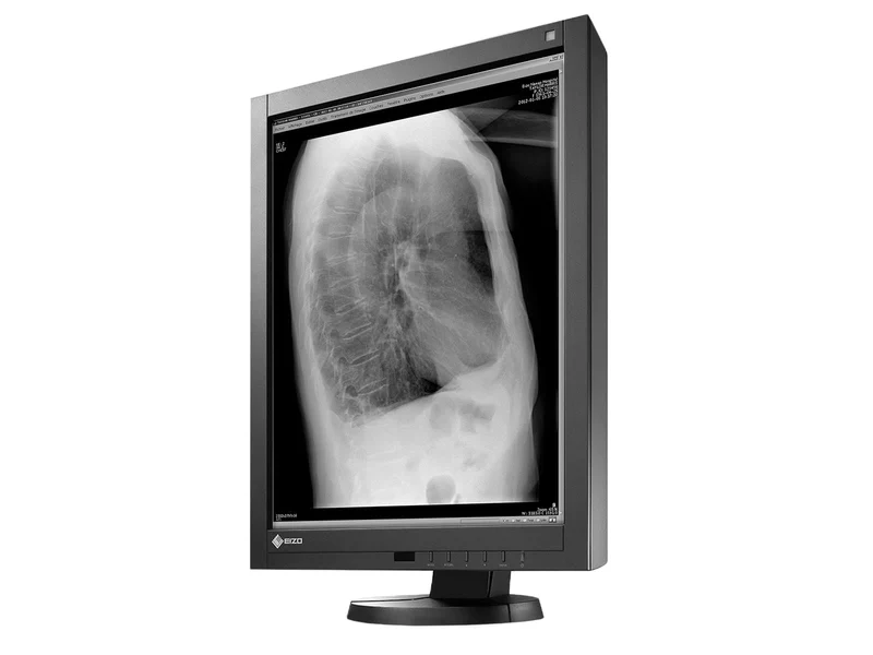 Eizo RadiForce GX340 3MP 21" Grayscale General Radiology Diagnostic Display Monitor (GX340-CL)