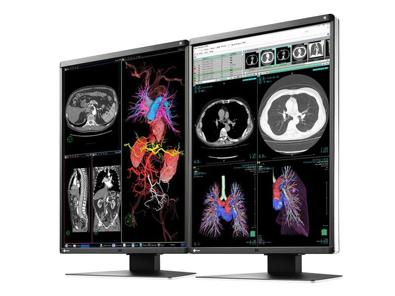 Eizo RadiForce RX360 3MP 21" Color General Radiology PACS Display Monitor (RX360)