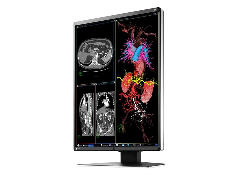 Eizo RadiForce RX360 3MP 21" Color General Radiology PACS Display Monitor (RX360)