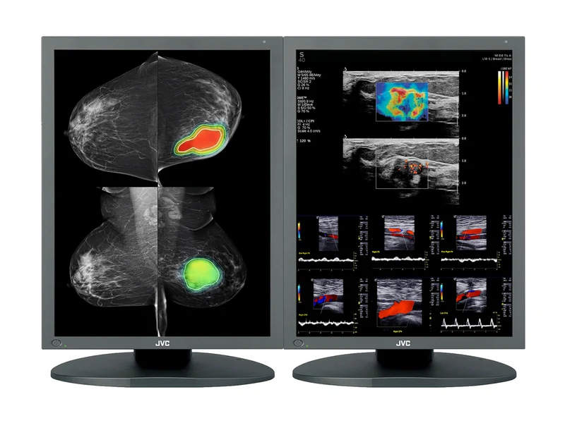 JVC Totoku CCL550i2 5MP 21" Color Mammo 3D-DBT Breast Imaging Display (CCL550i2)