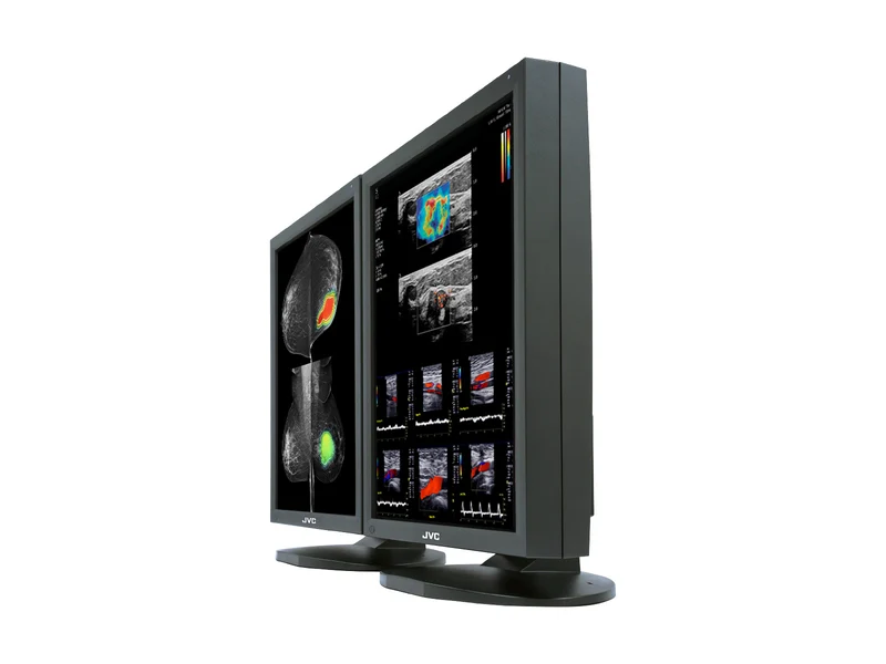 JVC Totoku CCL550i2 5MP 21" Color Mammo 3D-DBT Breast Imaging Display (CCL550i2)