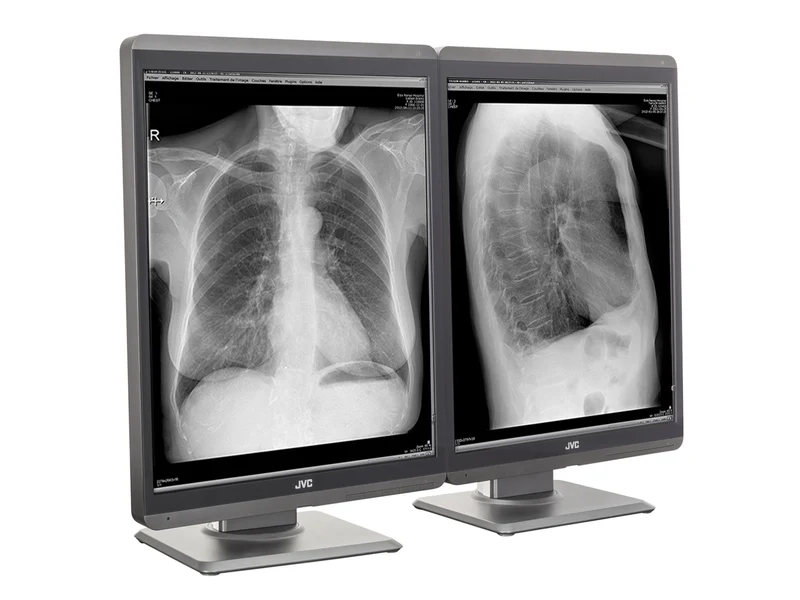 JVC Totoku MS-S200 2MP 21" Grayscale Diagnostic Radiology Display Monitor (MS-S200)