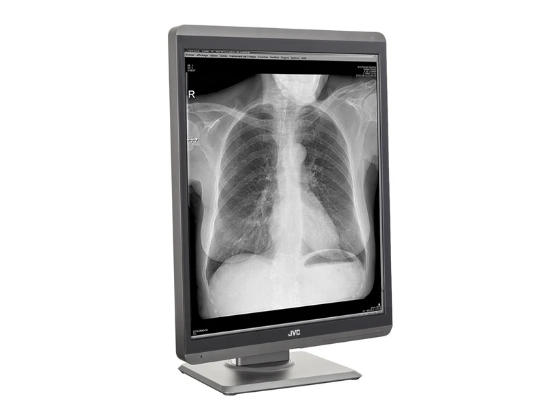 JVC Totoku MS-S200 2MP 21" Grayscale Diagnostic Radiology Display Monitor (MS-S200)