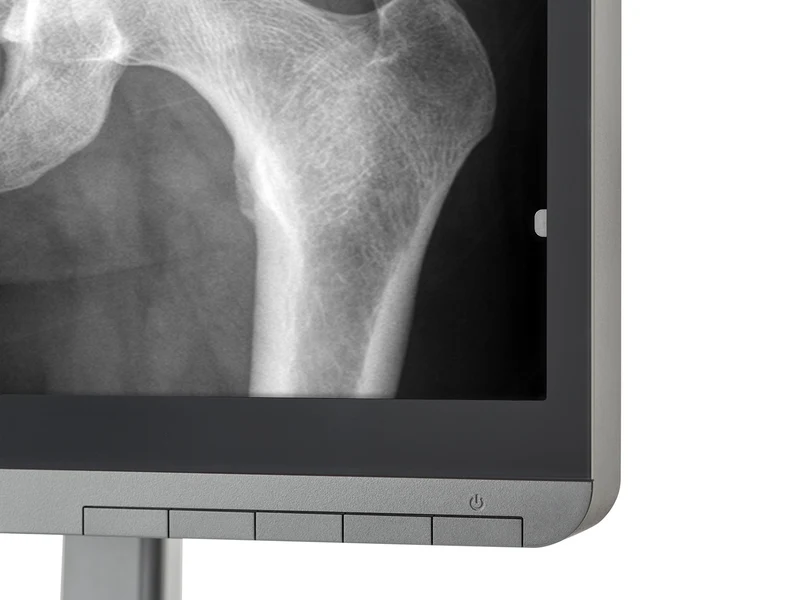 JVC Totoku MS-S200 2MP 21" Grayscale Diagnostic Radiology Display Monitor (MS-S200)