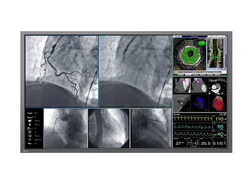 Eizo RadiForce LX600W 60.1" 8MP 4K Surgical Medical Display Monitor (LX600W)