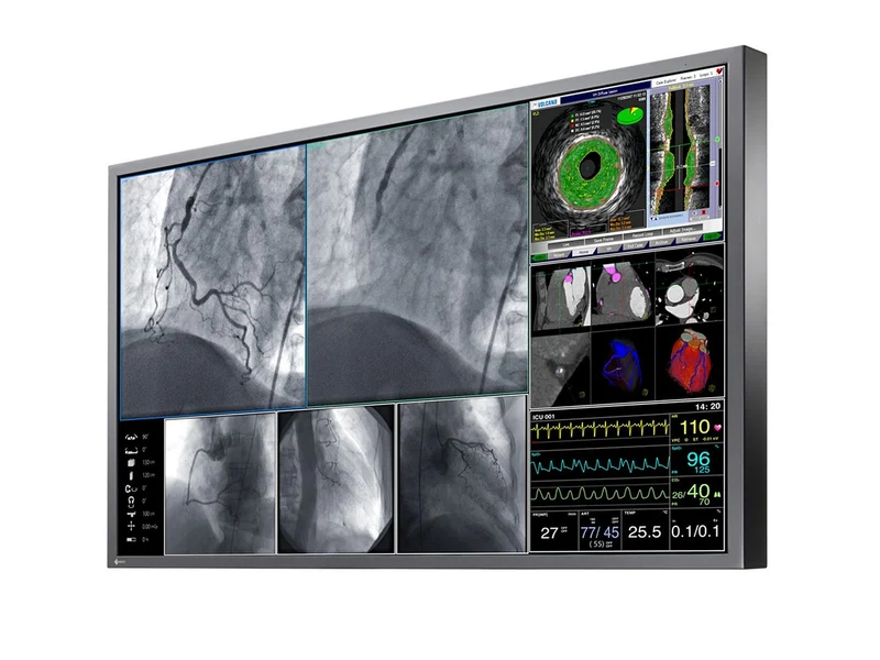 Eizo RadiForce LX600W 60.1" 8MP 4K Surgical Medical Display Monitor (LX600W)