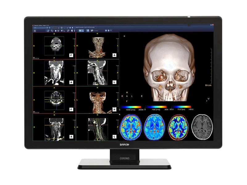 Barco Coronis Fusion MDCC-4430 4MP 30" Color Medical Diagnostic PACS Display