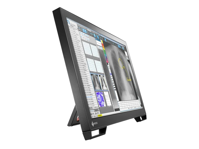 Eizo Radiforce MS236WT 2MP 23" Multi-Touch Color Clinical Review Dental Monitor with Stylus Pen (MS236WT)