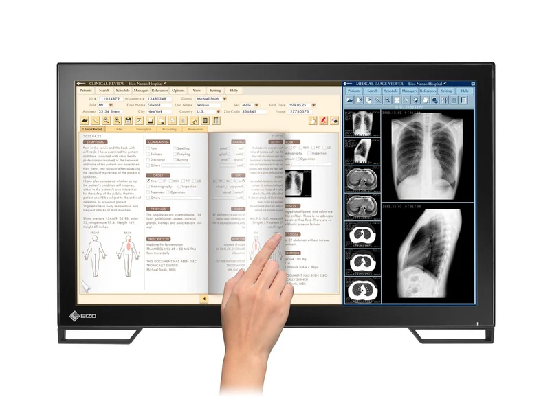 Eizo Radiforce MS236WT 2MP 23" Multi-Touch Color Clinical Review Dental Monitor with Stylus Pen (MS236WT)