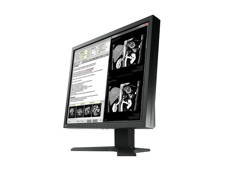 Eizo Radiforce MX194 1MP 19" Clinical Review Monitor (MX194)