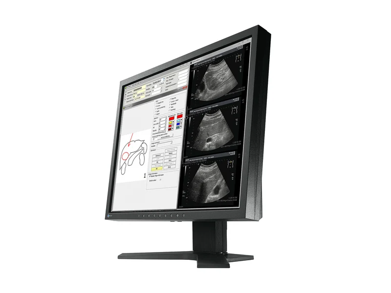 Eizo Radiforce MX194 1MP 19" Clinical Review Monitor (MX194)