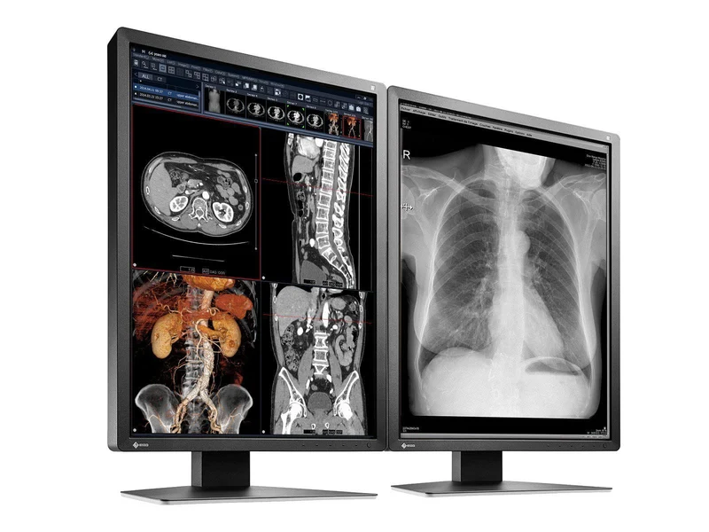 Eizo RadiForce MX216 2MP 21" Color Medical Display Monitor (MX216-BK)