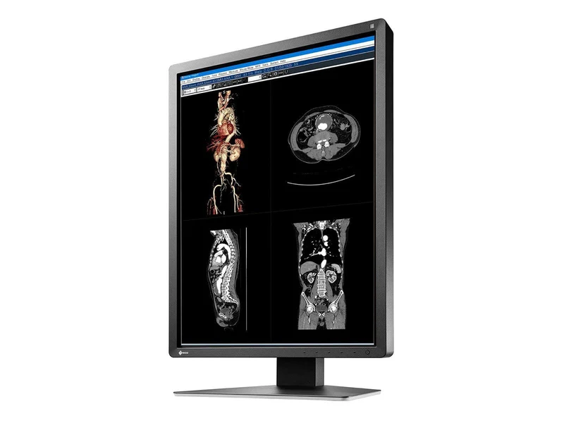 Eizo RadiForce MX216 2MP 21" Color Medical Display Monitor (MX216-BK)