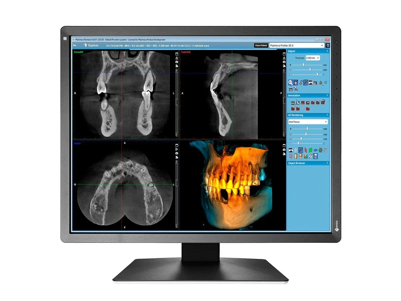 Eizo RadiForce MX216 2MP 21" Color Medical Display Monitor (MX216-BK)