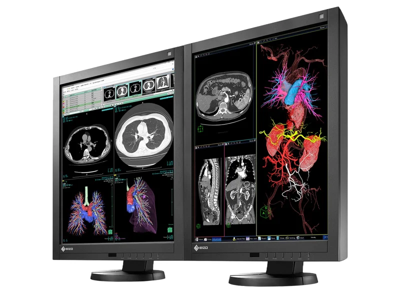 Eizo Radiforce RX240 2MP 21" Color General Radiology Diagnostic PACS Display (RX240)