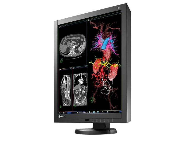 Eizo Radiforce RX240 2MP 21" Color General Radiology Diagnostic PACS Display (RX240)
