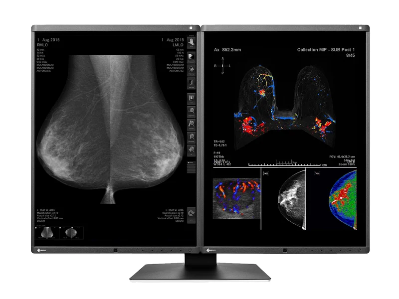 Eizo RadiForce RX560 5MP 21" Color Mammo 3D-DBT Breast Imaging Display (RX560-BK)