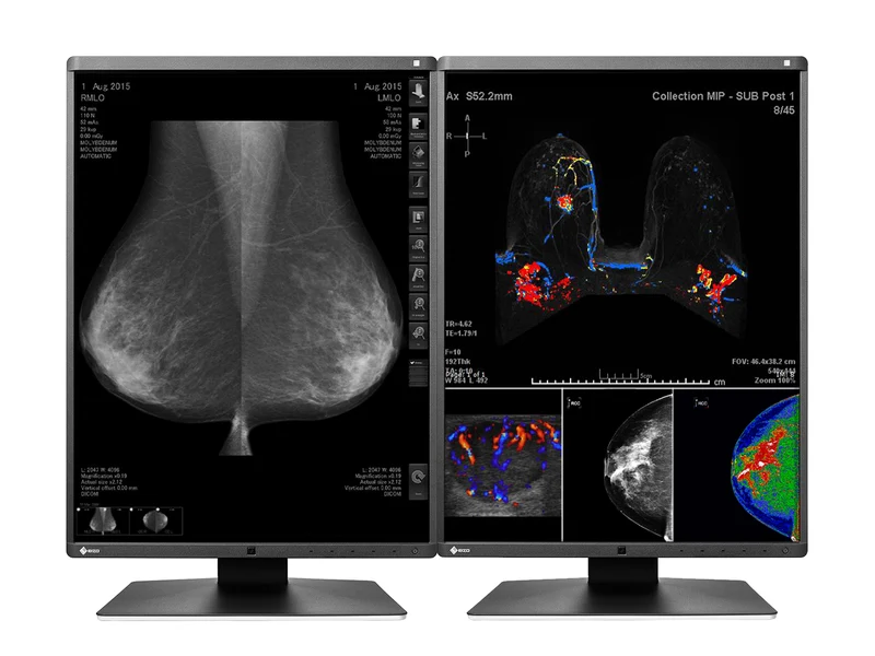 Eizo RadiForce RX560 5MP 21" Color Mammo 3D-DBT Breast Imaging Display (RX560-BK)
