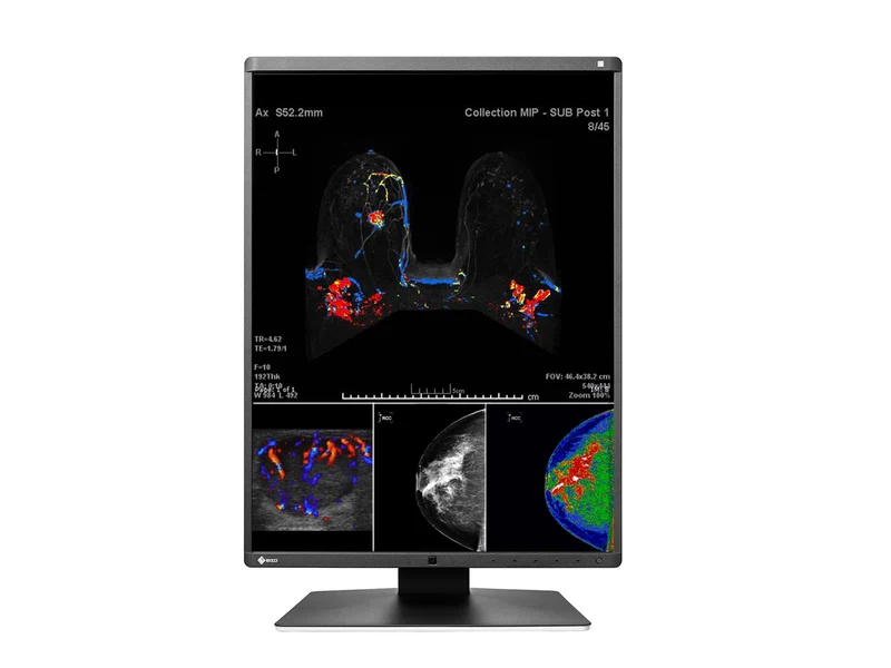 Eizo RadiForce RX560 5MP 21" Color Mammo 3D-DBT Breast Imaging Display (RX560-BK)
