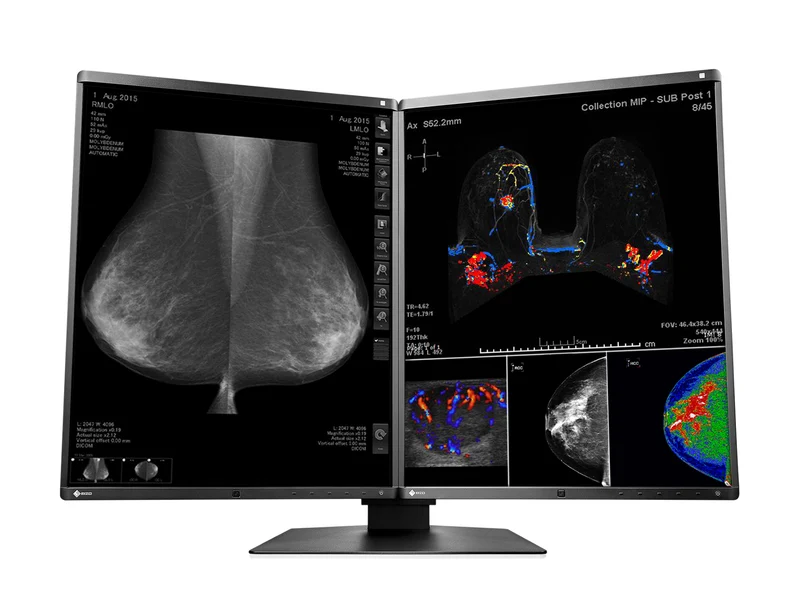 Eizo RadiForce RX560 5MP 21" Color Mammo 3D-DBT Breast Imaging Display (RX560-BK)
