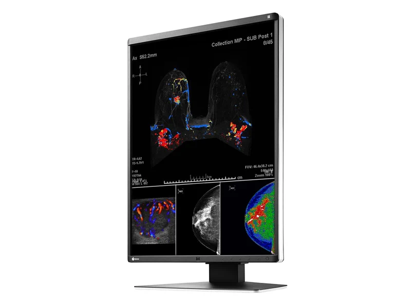 Eizo RadiForce RX560 5MP 21" Color Mammo 3D-DBT Breast Imaging Display (RX560-BK)