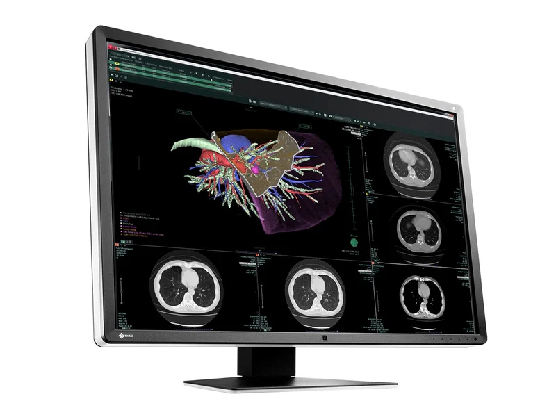 Eizo RadiForce RX660 6MP 30" Color General Radiology PACS Display (RX660-AR)