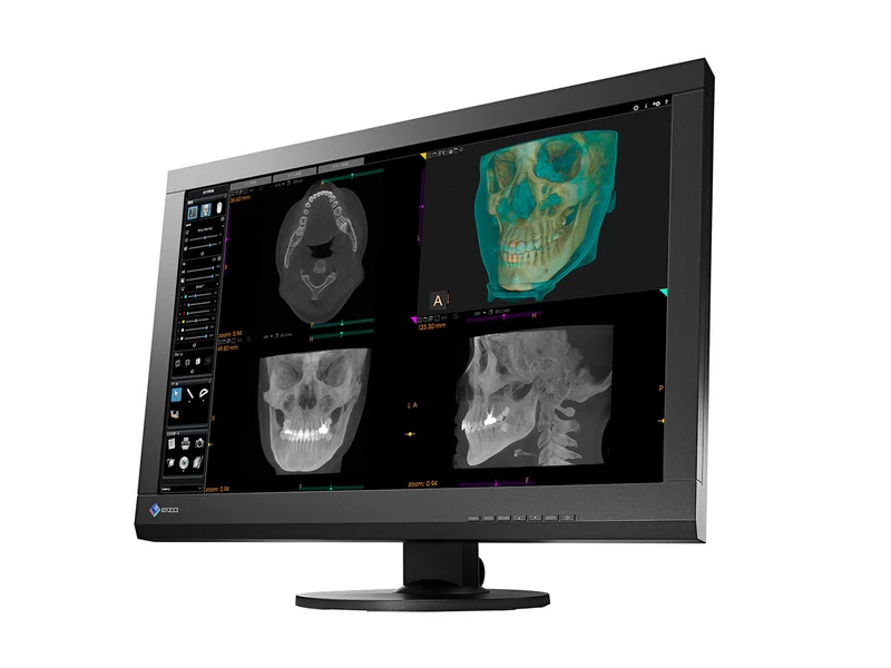 Eizo RadiForce MX242W 2.3MP 24" Color Clinical Review Display (MX242W-BK)