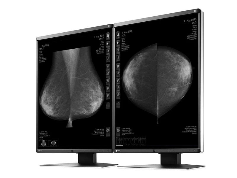 Eizo RadiForce GX560 5MP 21" Grayscale Mammo 3D-DBT Breast Imaging Display Monitor (GX560-MD)