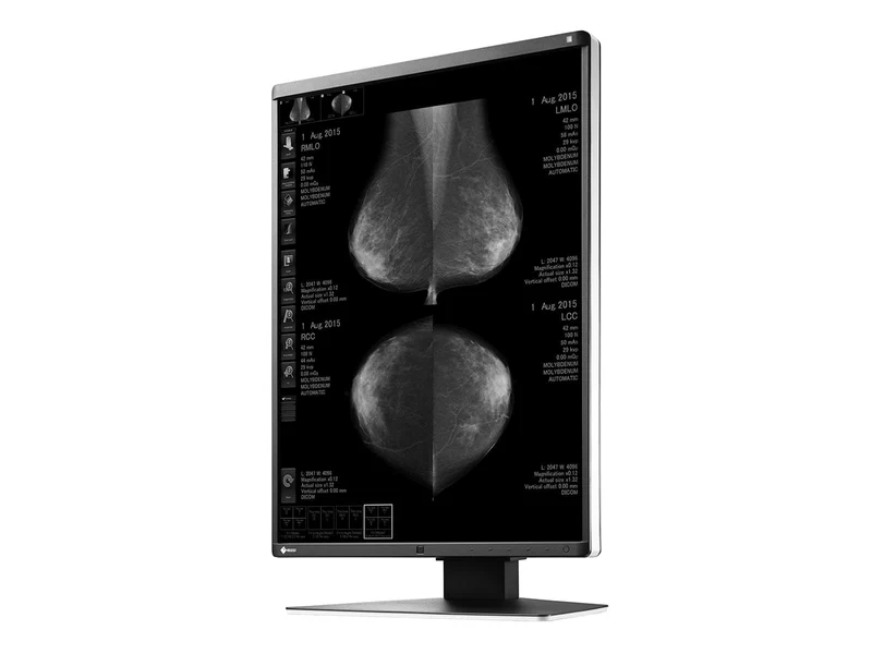 Eizo RadiForce GX560 5MP 21" Grayscale Mammo 3D-DBT Breast Imaging Display Monitor (GX560-MD)