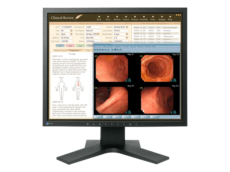Eizo RadiForce MX191 1MP 19" Color Clinical Review Monitor (MX191)