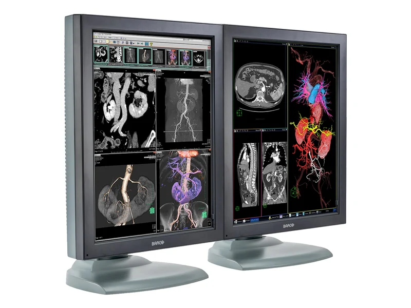 Barco Nio MDNC-3121 HighBright 3MP 21" Color Medical Diagnostic Radiology Monitor