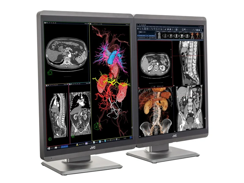 JVC Totoku CL-S300 3MP 21" Color General Radiology Diagnostic Display Monitors (CL-S300)