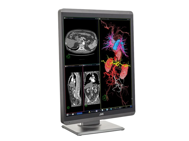 JVC Totoku CL-S300 3MP 21" Color General Radiology Diagnostic Display Monitors (CL-S300)